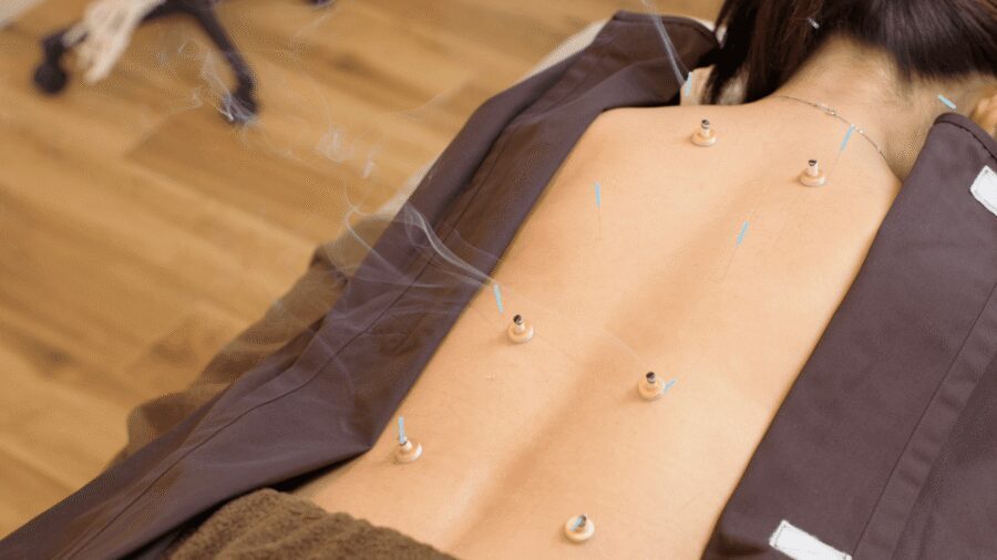 Hiroshima: Acupuncture and Japanese unique massage treatment - What to expect for your body: common feelings and how to manage them